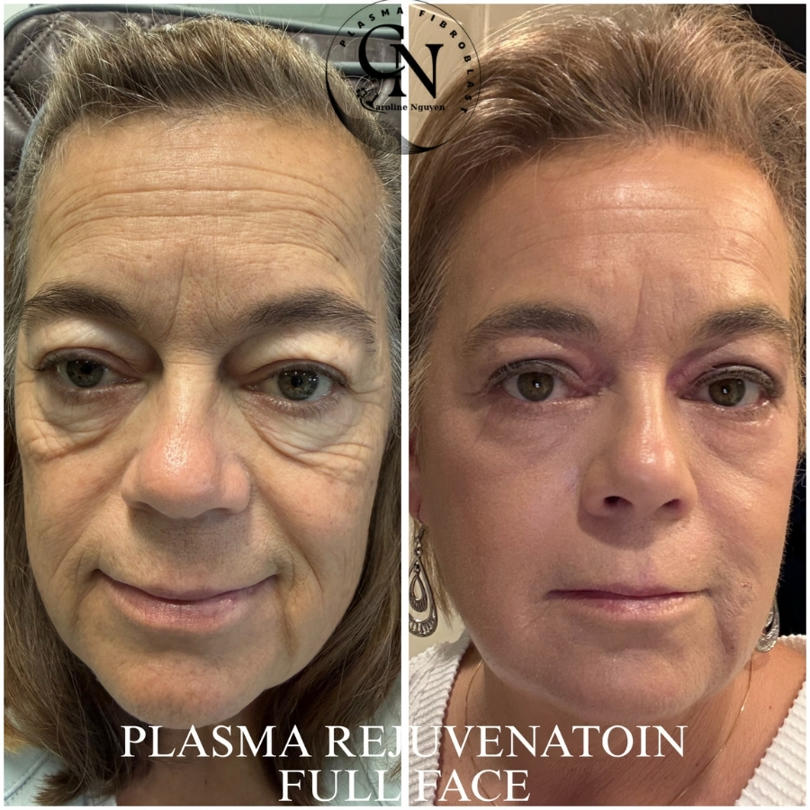 CAROLINE PERMANENT MAKEUP MICROBLADING EMERALD ISLE